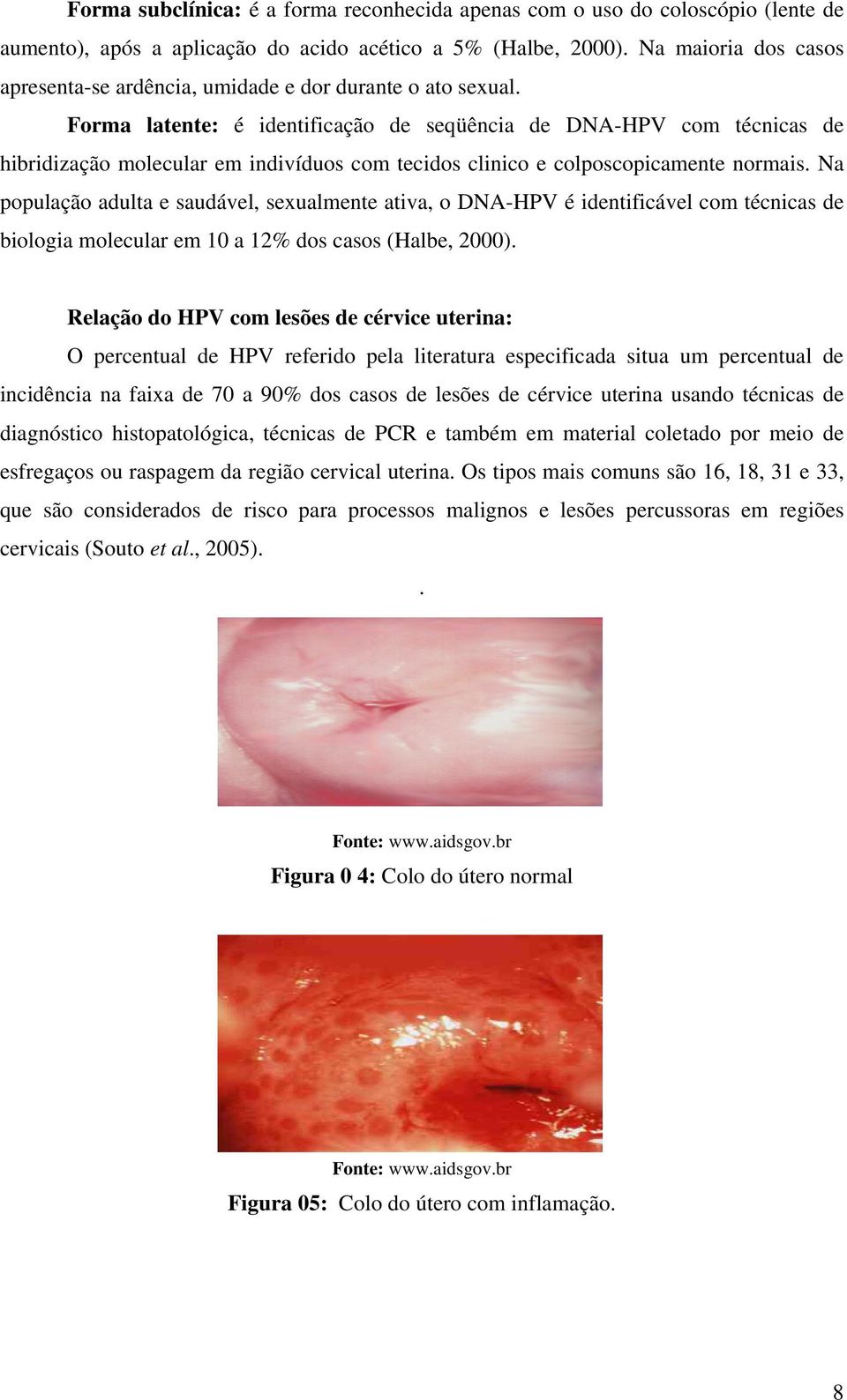 Forma latente: é identificação de seqüência de DNA-HPV com técnicas de hibridização molecular em indivíduos com tecidos clinico e colposcopicamente normais.