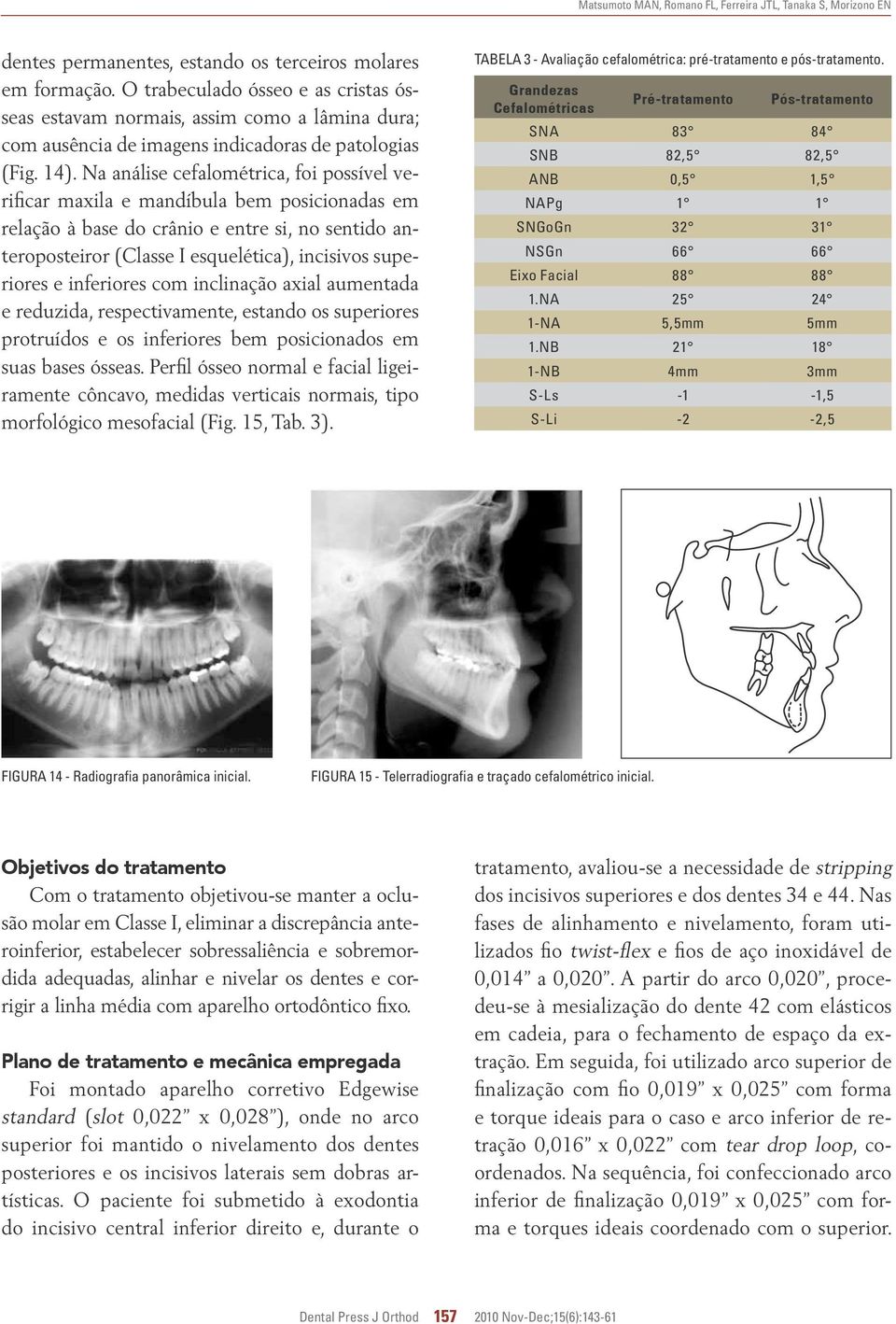 Na análise cefalométrica, foi possível verificar maxila e mandíbula bem posicionadas em relação à base do crânio e entre si, no sentido anteroposteiror (Classe I esquelética), incisivos superiores e