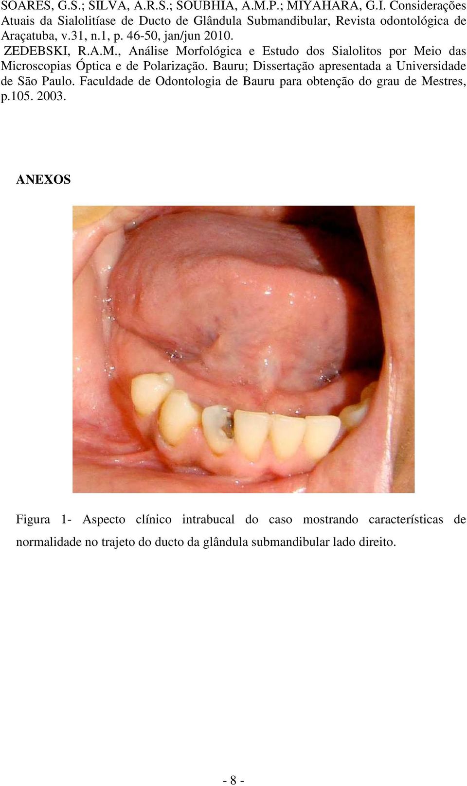 Bauru; Dissertação apresentada a Universidade de São Paulo. Faculdade de Odontologia de Bauru para obtenção do grau de Mestres, p.105. 2003.