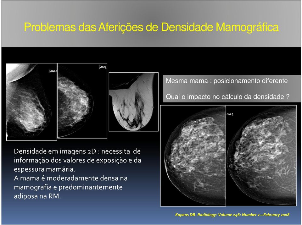 Densidade em imagens 2D : necessita de informação dos valores de exposição e da espessura