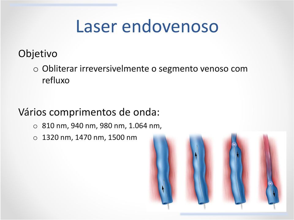 refluxo Vários comprimentos de onda: o 810