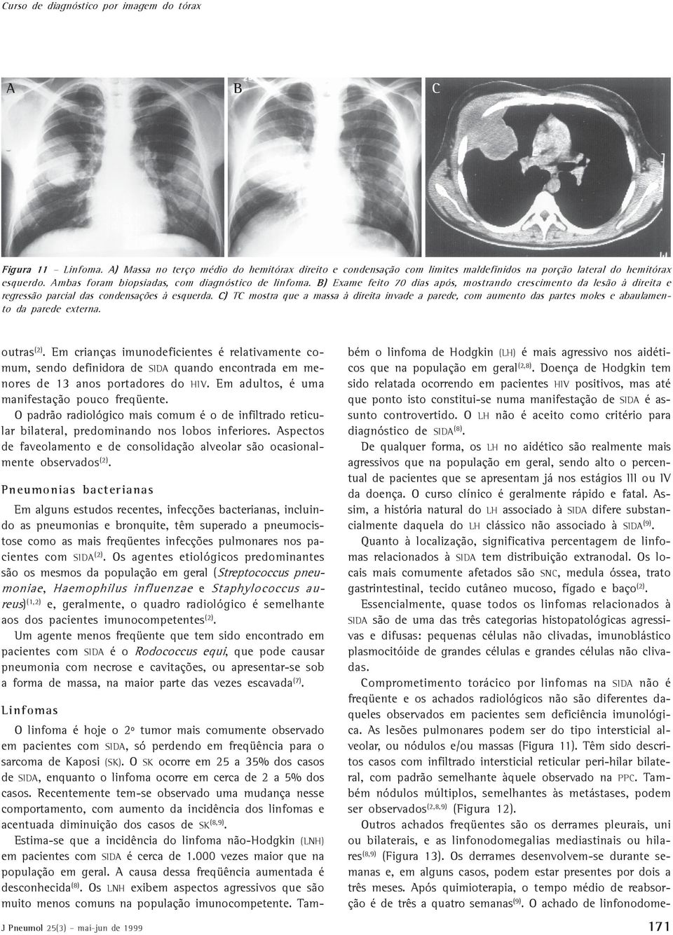 C) TC mostra que a massa à direita invade a parede, com aumento das partes moles e abaulamento da parede externa. outras (2).