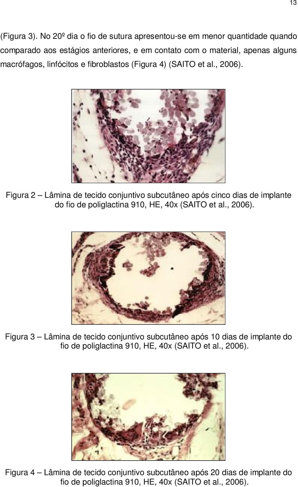 macrófagos, linfócitos e fibroblastos (Figura 4) (SAITO et al., 2006).