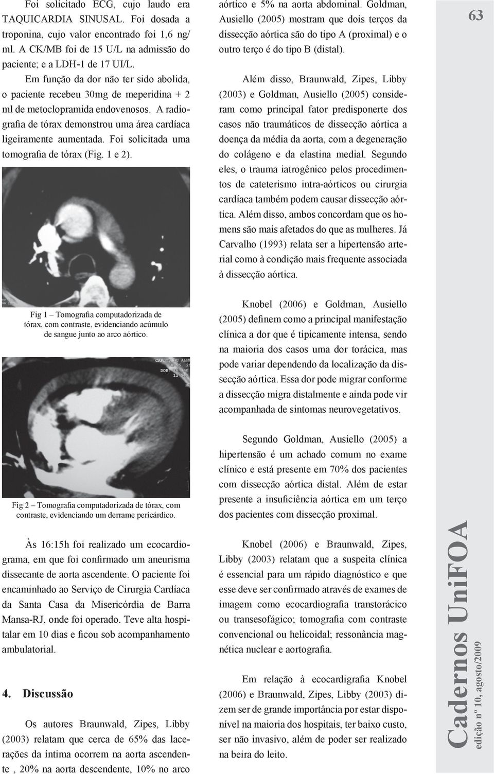 Foi solicitada uma tomografia de tórax (Fig. 1 e 2). aórtico e 5% na aorta abdominal.