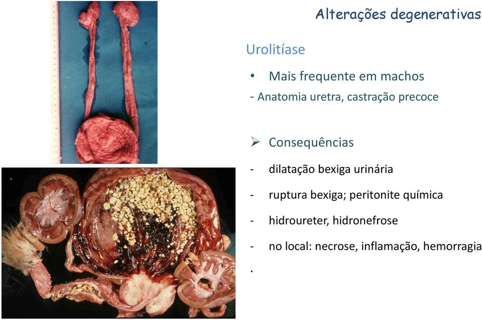 dilatação bexiga urinária ruptura bexiga; peritonite