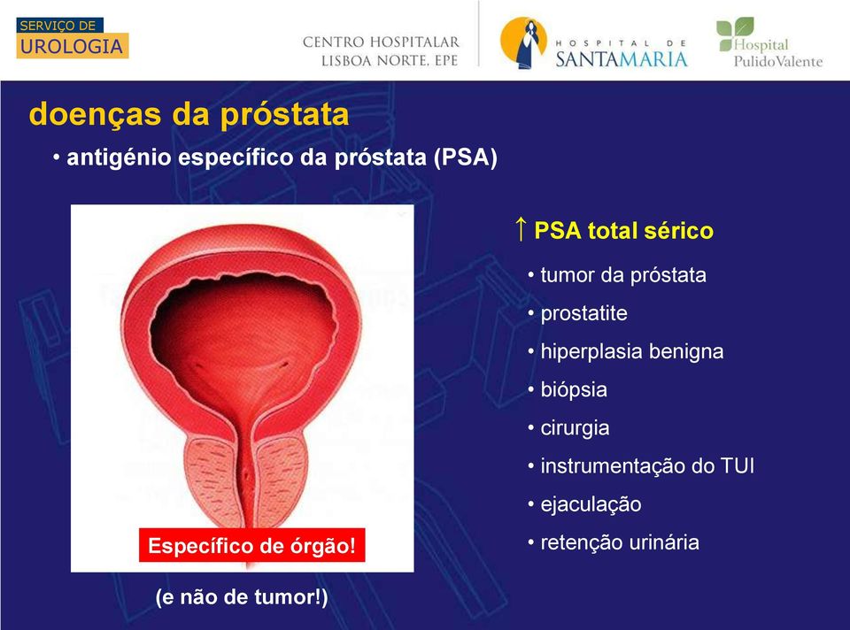 hiperplasia benigna biópsia cirurgia instrumentação do