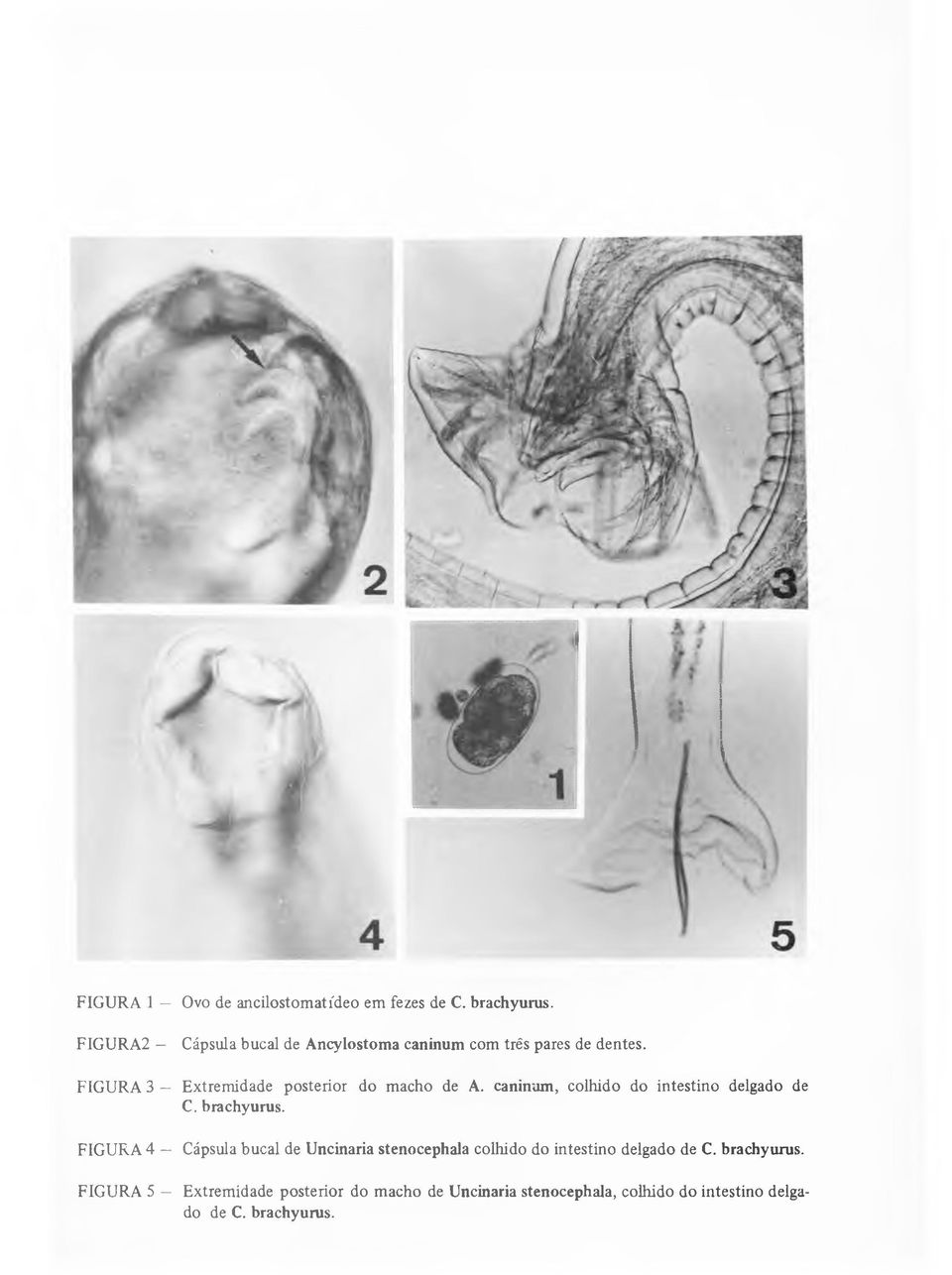 F IG U R A 3 Extremidade posterior do macho de A. caninum, colhido do intestino delgado de C. brachyurus.