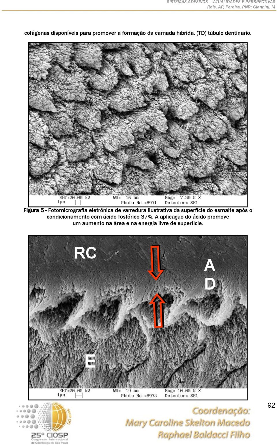 Figura 5 - Fotomicrografia eletrônica de varredura ilustrativa da superfície do