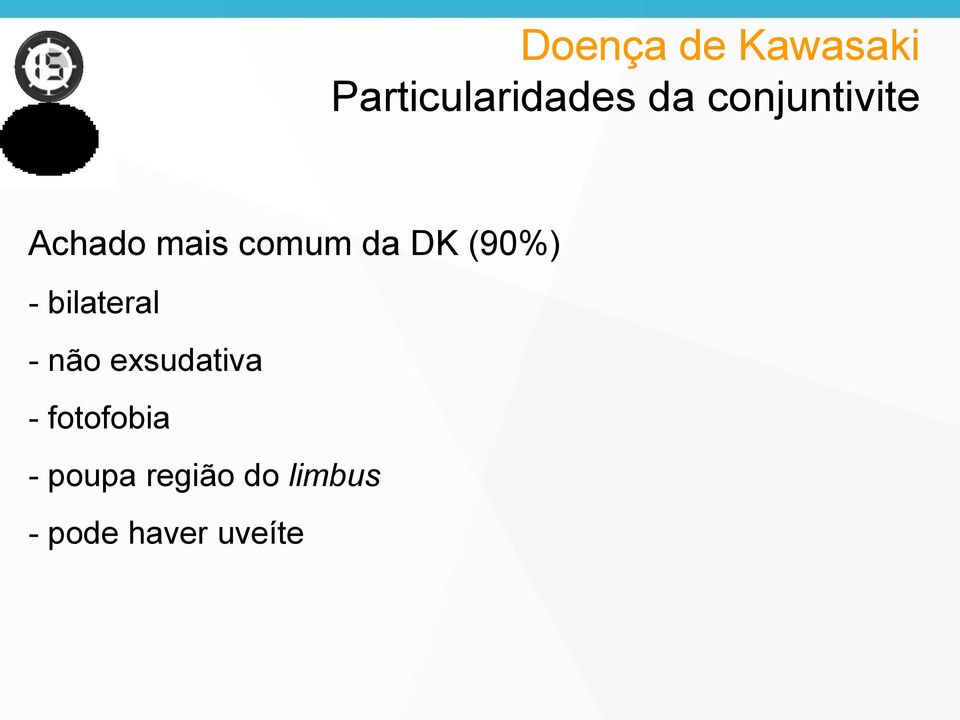 (90%) - bilateral - não exsudativa -