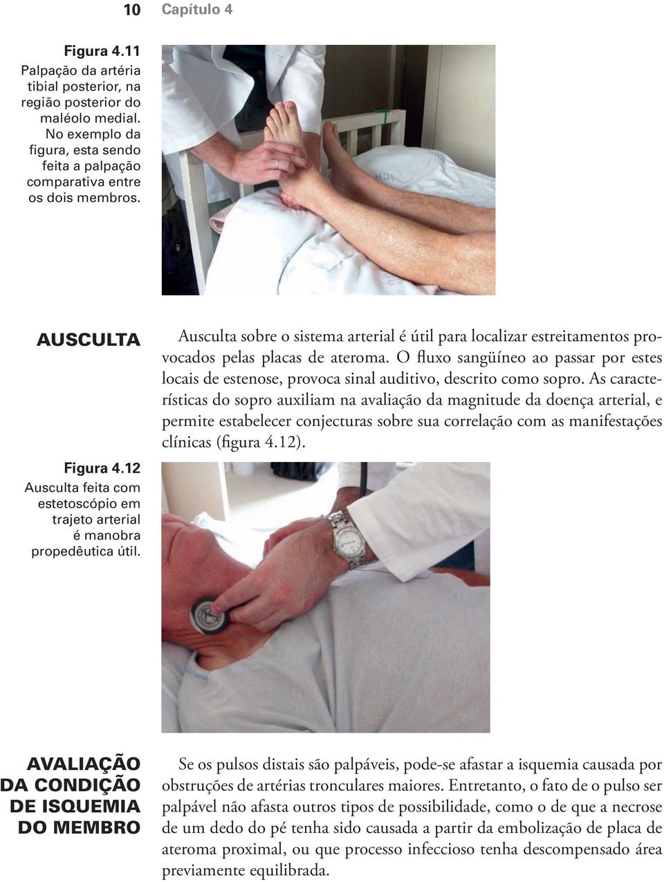 Ausculta sobre o sistema arterial é útil para localizar estreitamentos provocados pelas placas de ateroma.