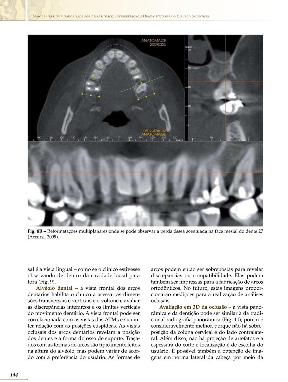 sal é a vista lingual como se o clínico estivesse observando de dentro da cavidade bucal para fora (Fig. 9).