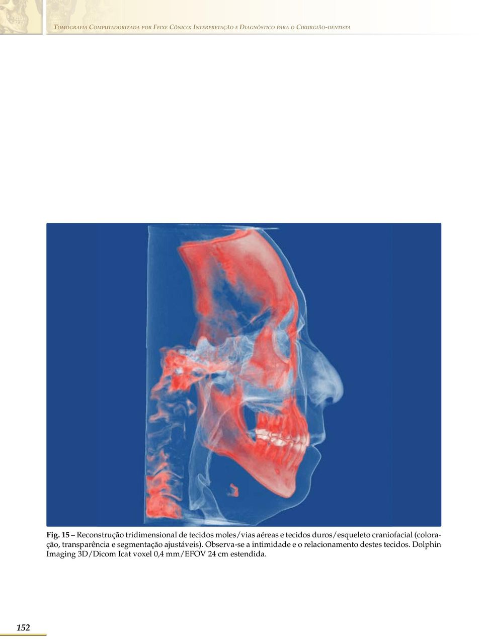 15 Reconstrução tridimensional de tecidos moles/vias aéreas e tecidos duros/esqueleto