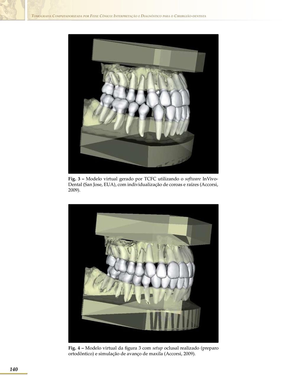 3 Modelo virtual gerado por TCFC utilizando o software InVivo- Dental (San Jose, EUA), com
