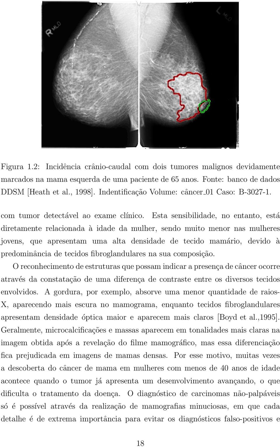 Esta sensibilidade, no entanto, está diretamente relacionada à idade da mulher, sendo muito menor nas mulheres jovens, que apresentam uma alta densidade de tecido mamário, devido à predominância de