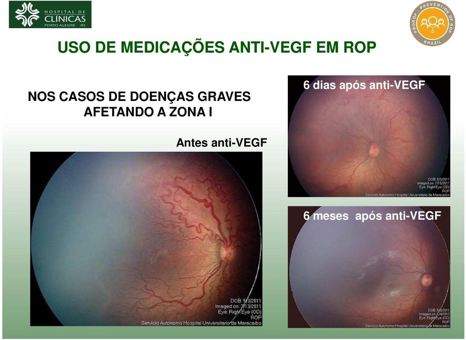 AFETANDO A ZONA I 6 dias após