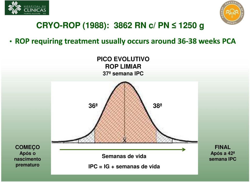 ROP LIMIAR 37ª semana IPC 36ª 38ª COMEÇO Após o nascimento