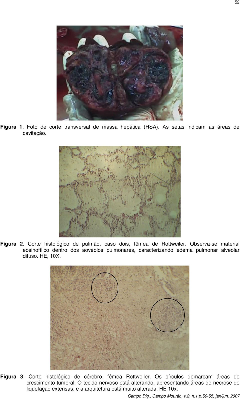 Observa-se material eosinofílico dentro dos aovéolos pulmonares, caracterizando edema pulmonar alveolar difuso. HE, 10X. Figura 3.