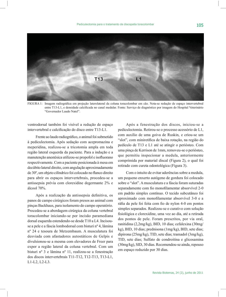 Com a paciente posicionada à mesa em decúbito lateral direito, com angulação aproximadamente para abrir os espaços intervertebrais, procedeu-se a antissepsia prévia com clorexidine degermante 2% e