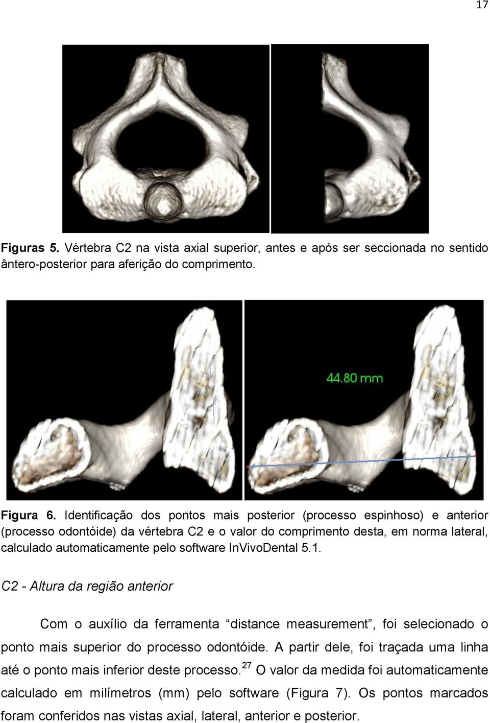 software InVivoDental 5.1. C2 - Altura da região anterior Com o auxílio da ferramenta distance measurement, foi selecionado o ponto mais superior do processo odontóide.