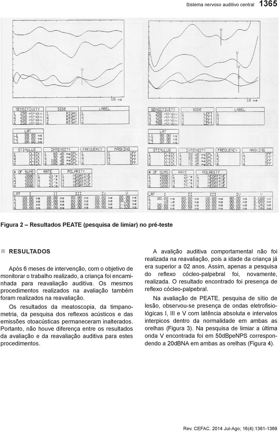 Os resultados da meatoscopia, da timpanometria, da pesquisa dos reflexos acústicos e das emissões otoacústicas permaneceram inalterados.