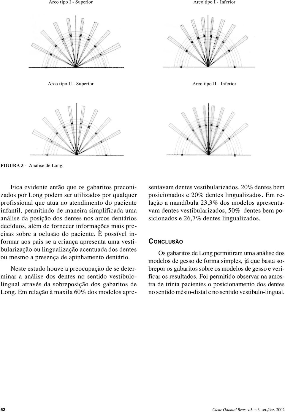 da posição dos dentes nos arcos dentários decíduos, além de fornecer informações mais precisas sobre a oclusão do paciente.