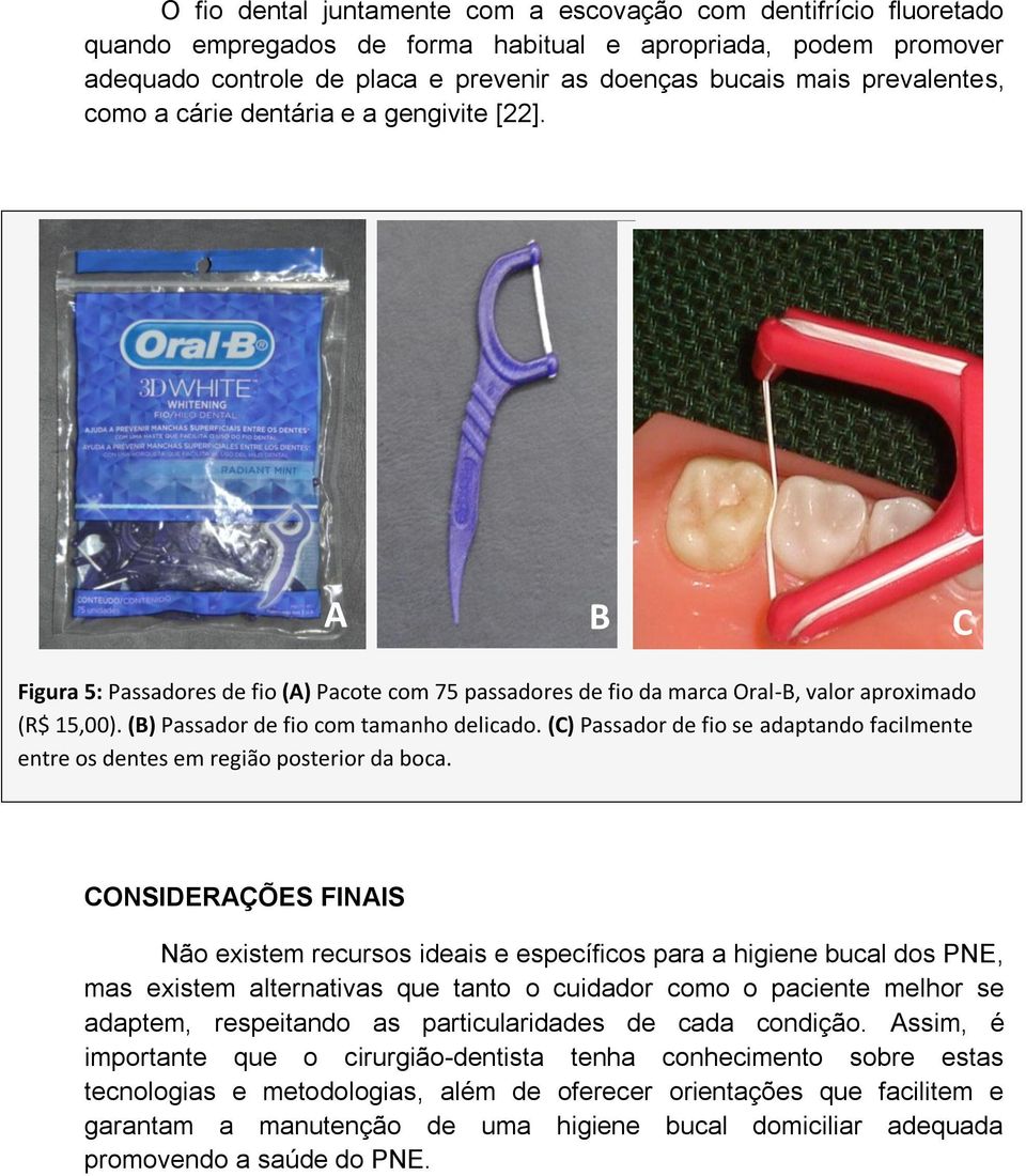 (B) Passador de fio com tamanho delicado. (C) Passador de fio se adaptando facilmente entre os dentes em região posterior da boca.