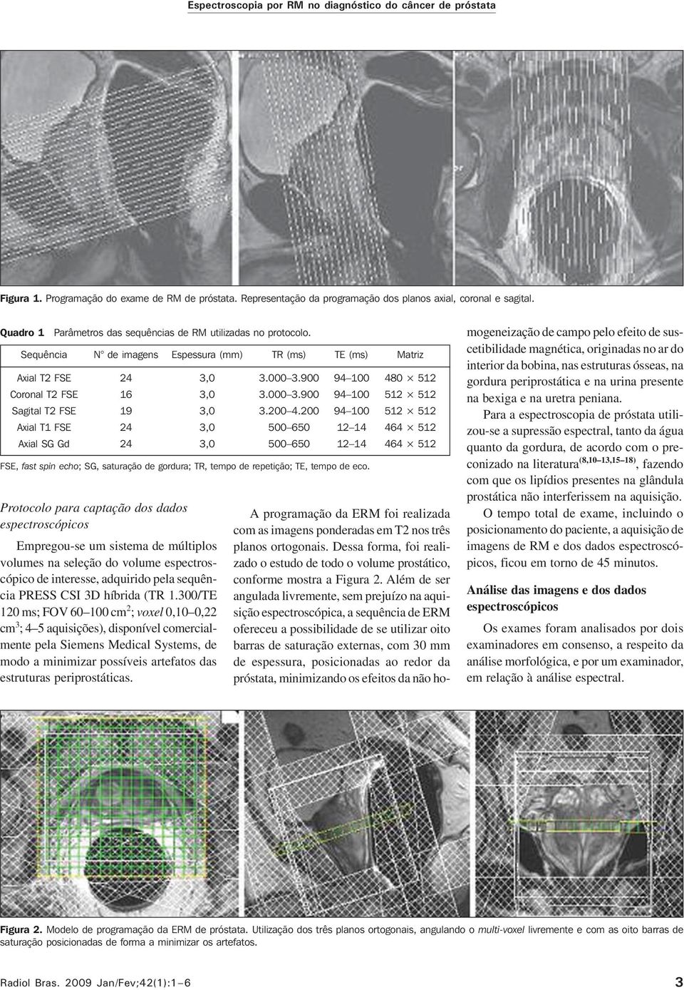 N de imagens 24 16 19 24 24 Espessura (mm) Protocolo para captação dos dados espectroscópicos Empregou-se um sistema de múltiplos volumes na seleção do volume espectroscópico de interesse, adquirido