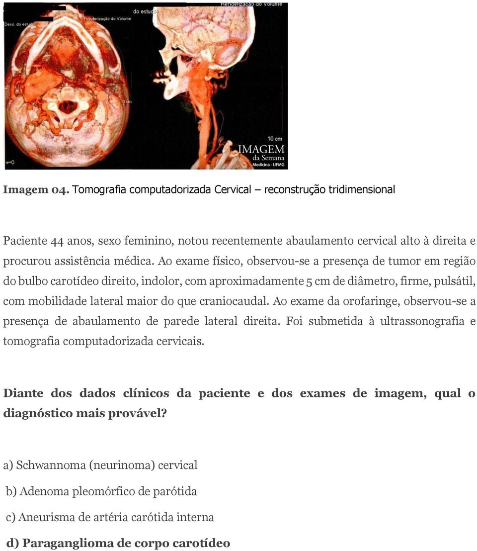 Ao exame da orofaringe, observou-se a presença de abaulamento de parede lateral direita. Foi submetida à ultrassonografia e tomografia computadorizada cervicais.