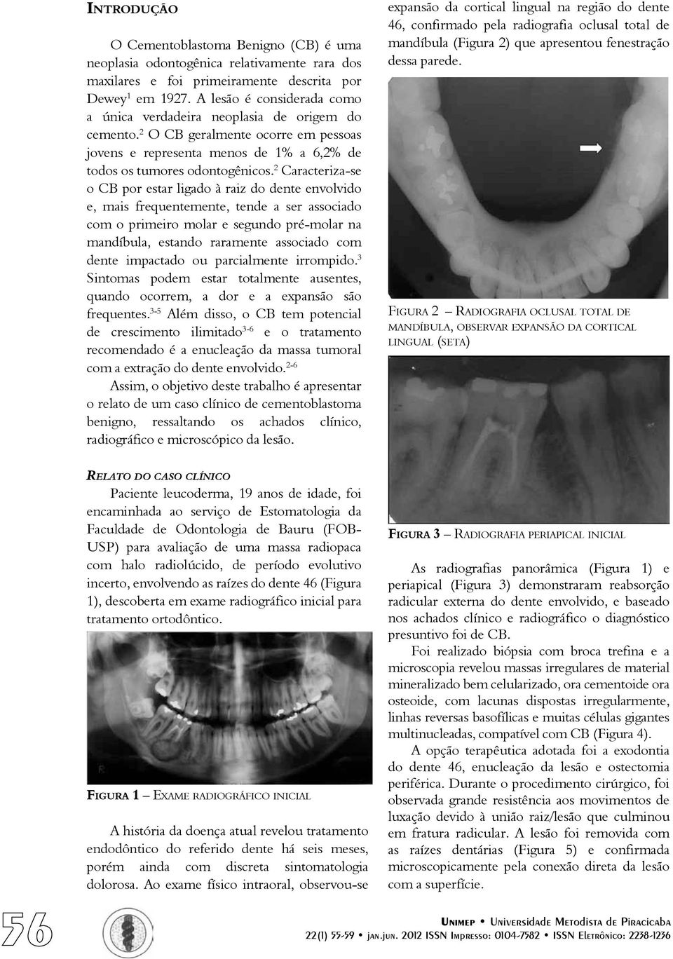 2 Caracteriza-se o CB por estar ligado à raiz do dente envolvido e, mais frequentemente, tende a ser associado com o primeiro molar e segundo pré-molar na mandíbula, estando raramente associado com