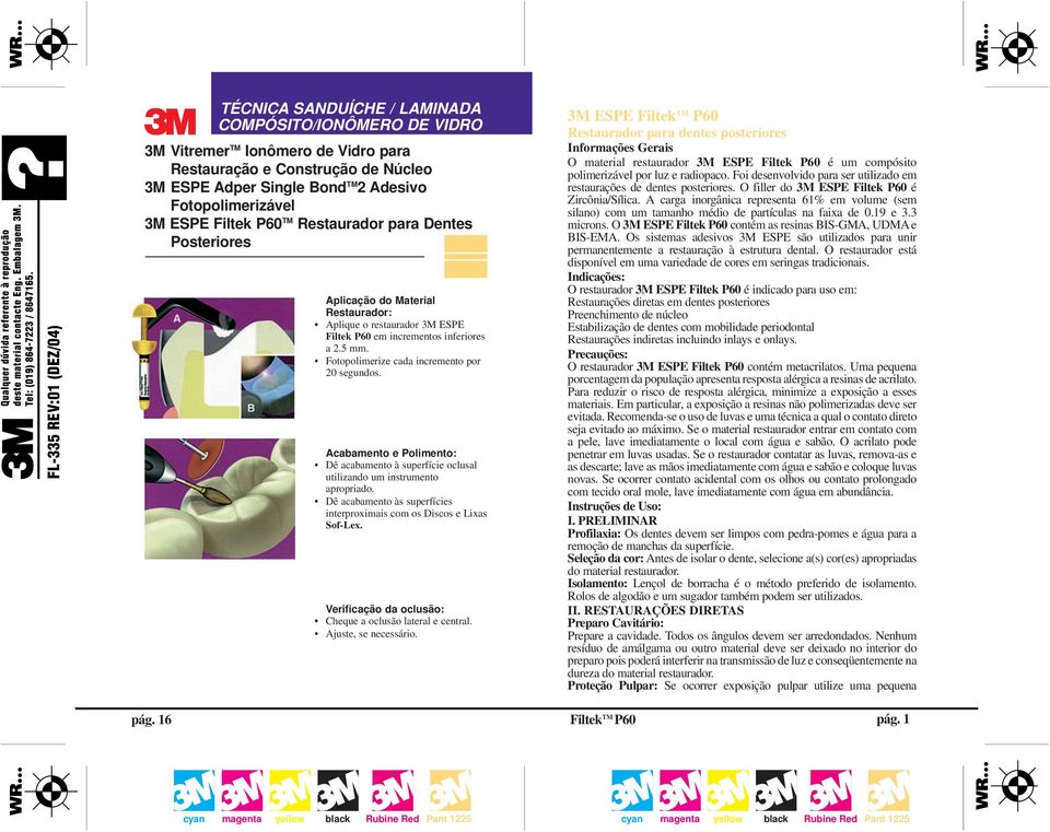 Fotopolimerize cada incremento por 20 segundos. Acabamento e Polimento: Dê acabamento à superfície oclusal utilizando um instrumento apropriado.