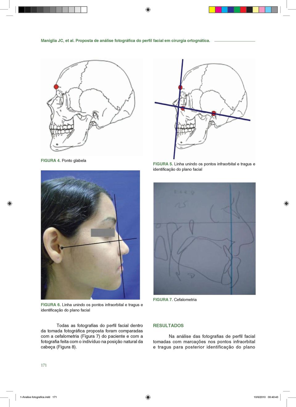 Cefalometria Todas as fotografias do perfil facial dentro da tomada fotográfica proposta foram comparadas com a cefalometria (Figura 7) do paciente e com a fotografia feita com o