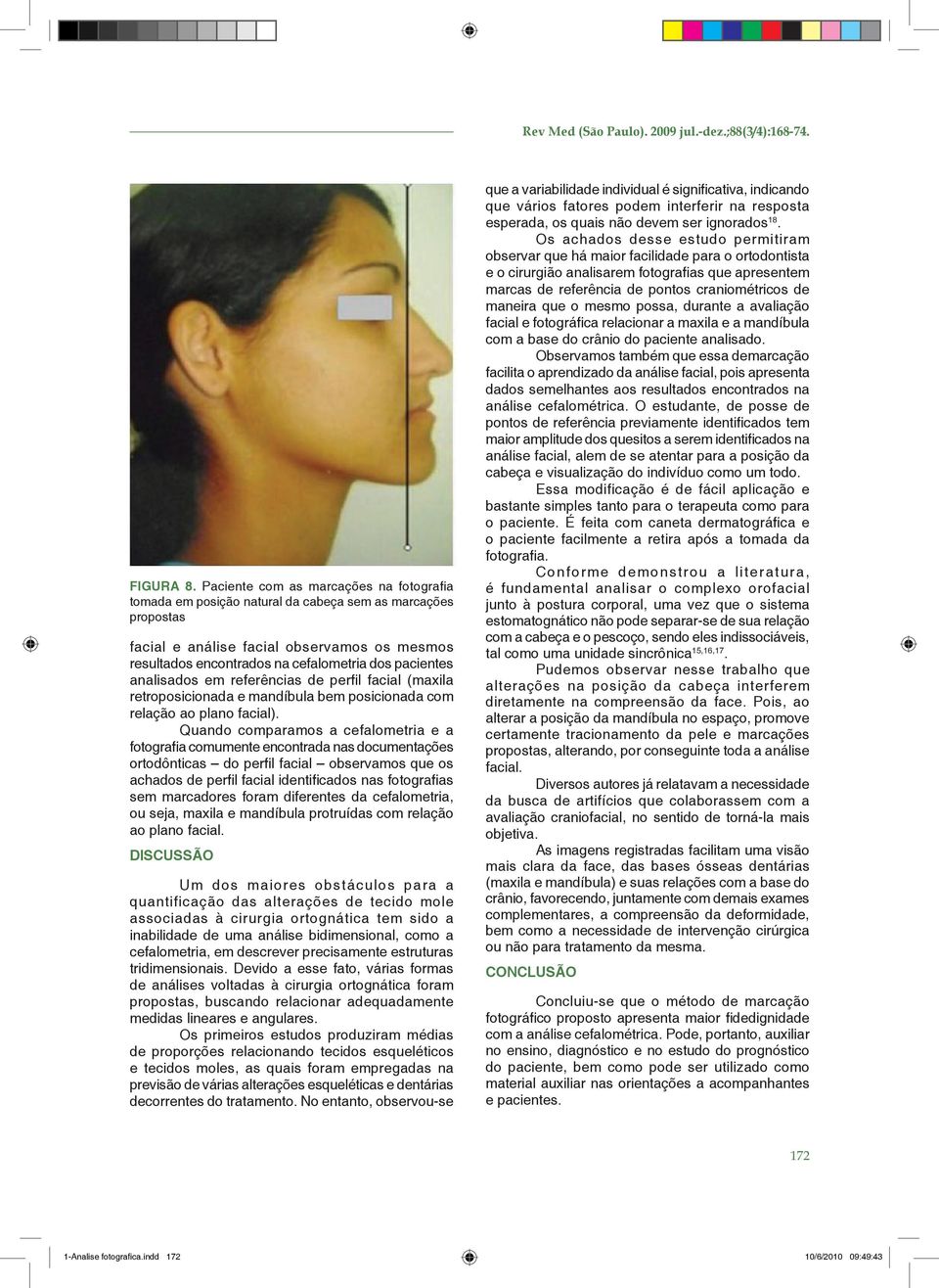 pacientes analisados em referências de perfil facial (maxila retroposicionada e mandíbula bem posicionada com relação ao plano facial).