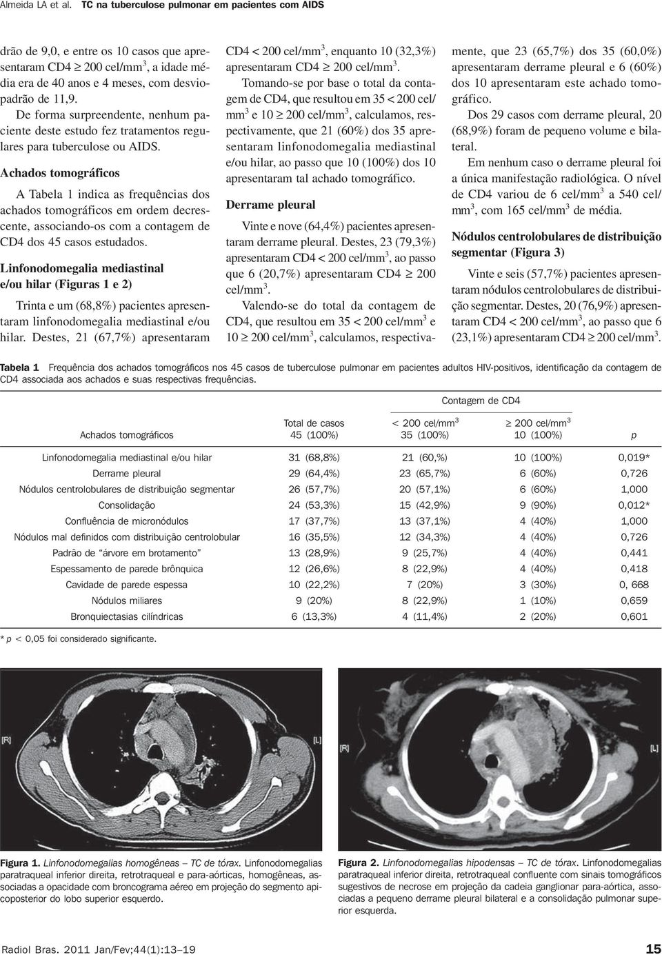 Achados tomográficos A Tabela 1 indica as frequências dos achados tomográficos em ordem decrescente, associando-os com a contagem de CD4 dos 45 casos estudados.