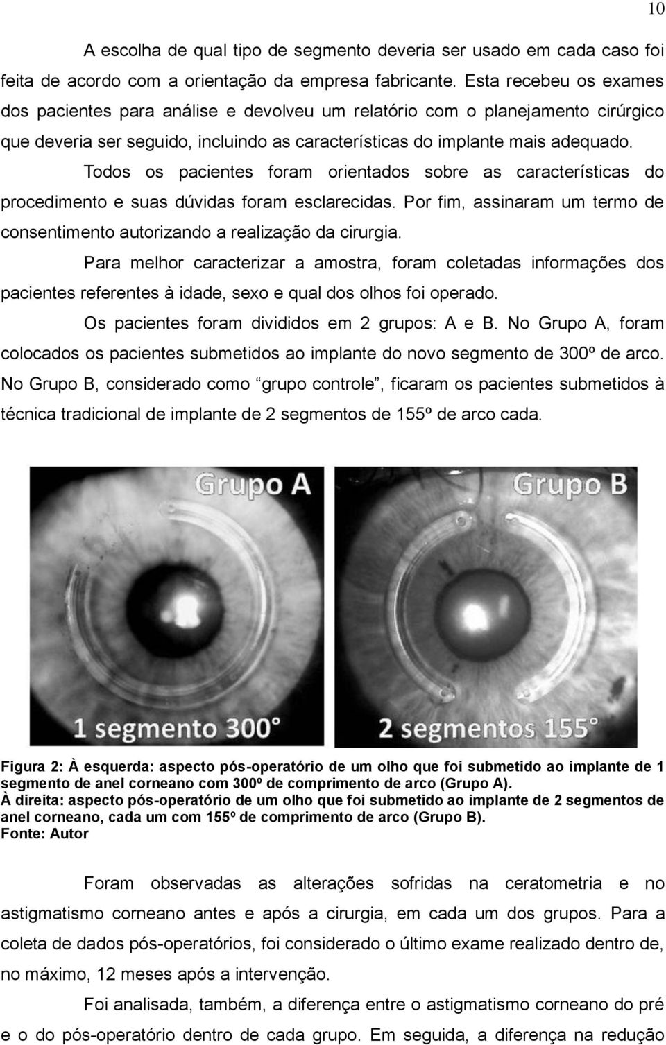 Todos os pacientes foram orientados sobre as características do procedimento e suas dúvidas foram esclarecidas. Por fim, assinaram um termo de consentimento autorizando a realização da cirurgia.