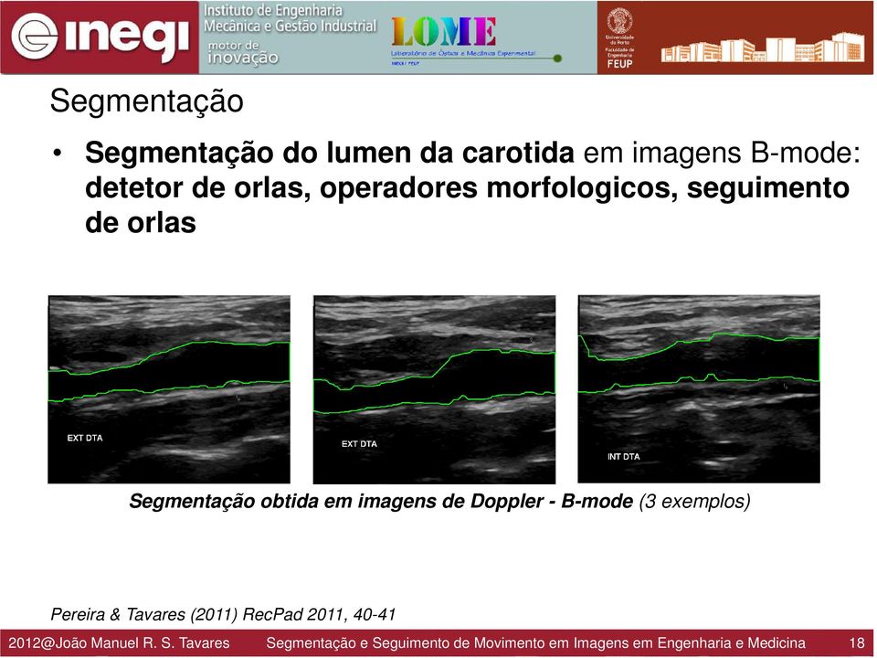 B-mode (3 exemplos) Pereira & Tavares (2011) RecPad 2011, 40-41 2012@João Manuel R.