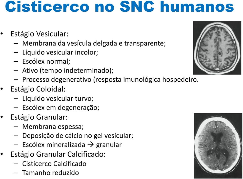 Estágio Coloidal: Líquido vesicular turvo; Escólex em degeneração; Estágio Granular: Membrana espessa; Deposição