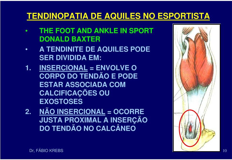 INSERCIONAL = ENVOLVE O CORPO DO TENDÃO E PODE ESTAR ASSOCIADA COM