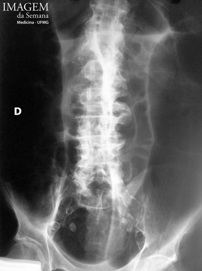 Imagem da Semana: Radiografia simples do abdômen Imagem 01.