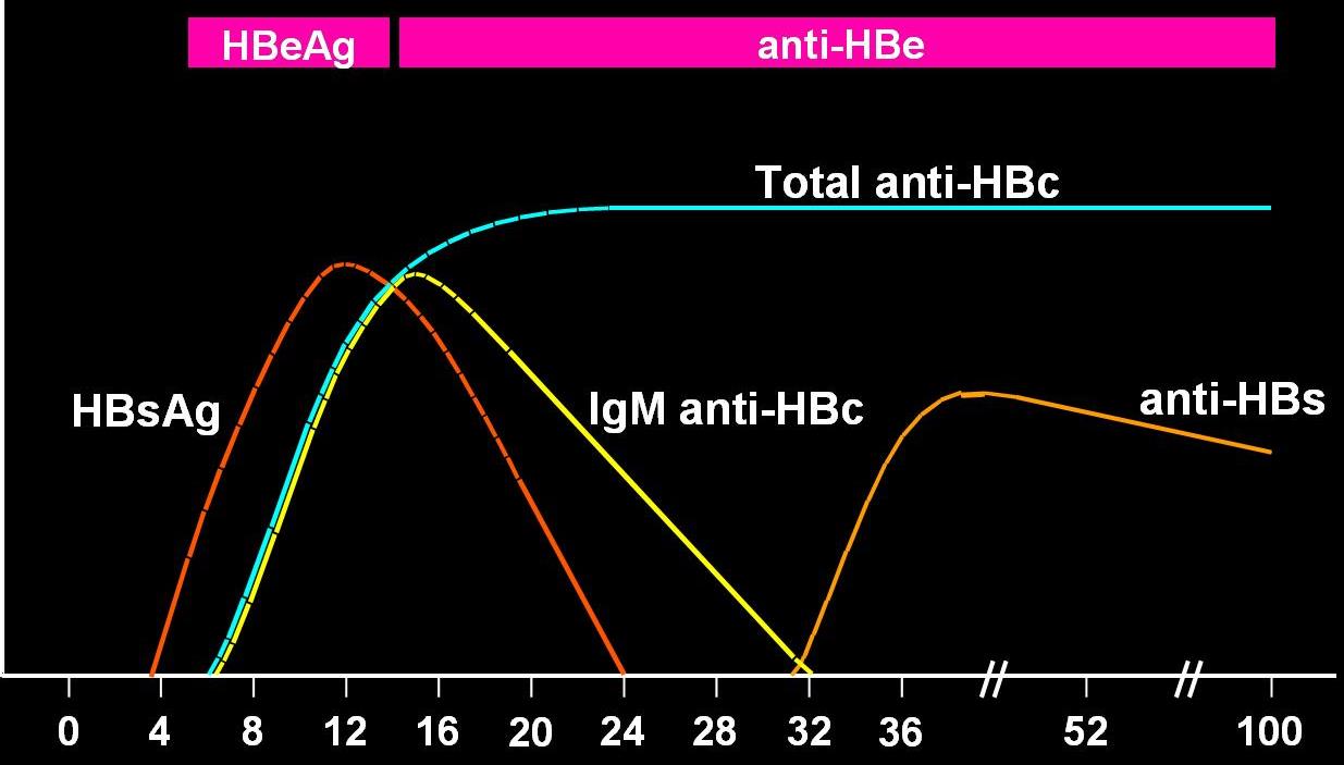 Passo 1: Identificar a infecção crônica pelo VHB - AgHBs (+) > 6 meses (5 a 10%, acima do 2º ano de vida) - Anti-HBc: