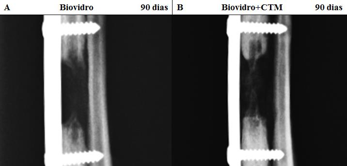 Figura 6: Imagens radiográficas de defeitos ossos críticos em rádios de cães, tratados com matriz porosa de biovidro 60S (A) e com a associação da matriz porosa de biovidro 60S à CTM-AD diferenciadas