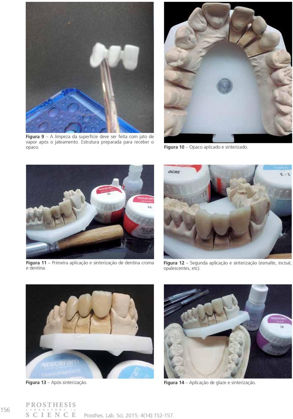 Figura 11 Primeira aplicação e sinterização de dentina croma e dentina.