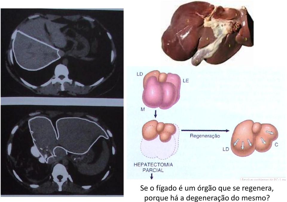 regenera, porque