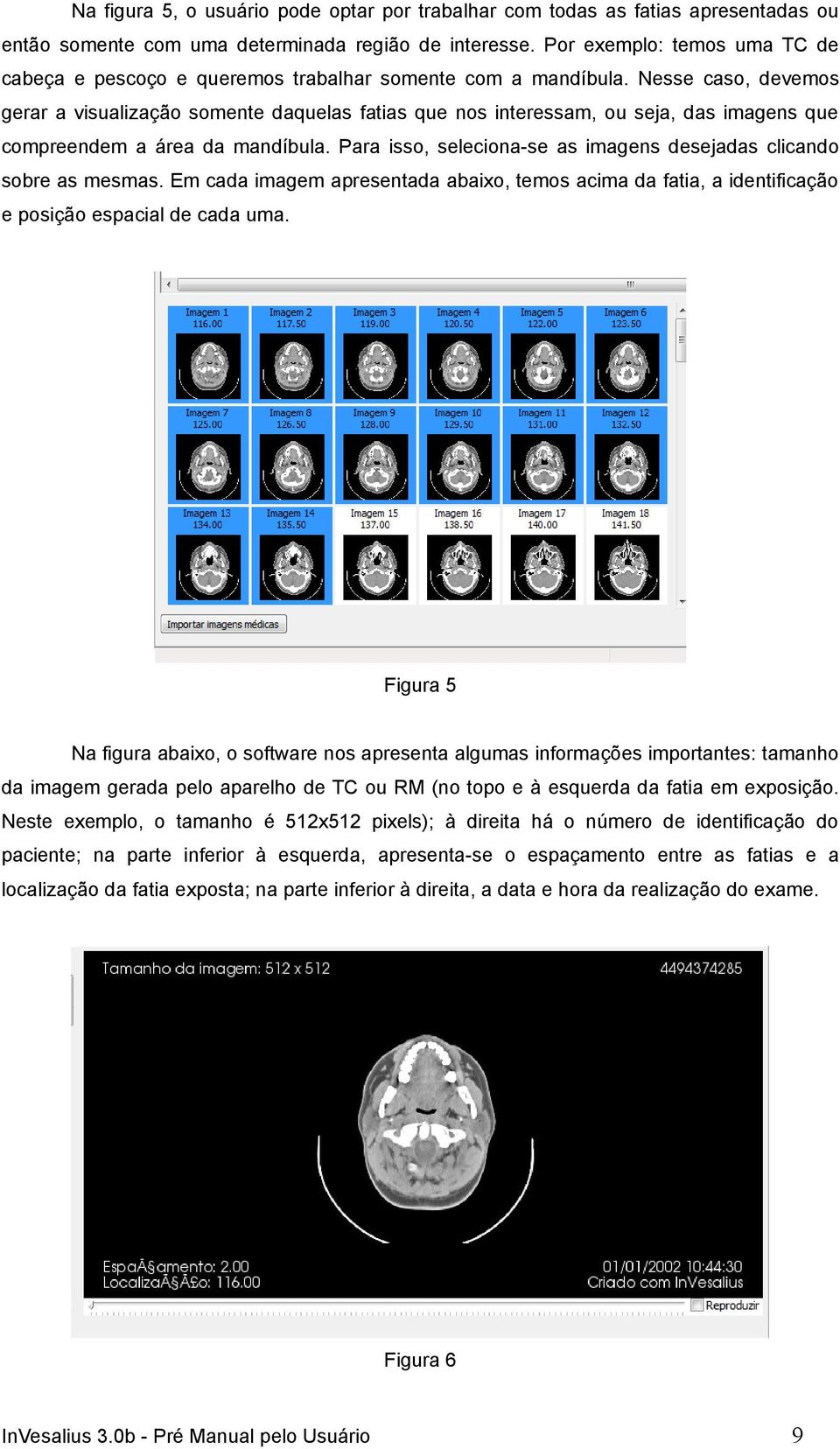 Nesse caso, devemos gerar a visualização somente daquelas fatias que nos interessam, ou seja, das imagens que compreendem a área da mandíbula.