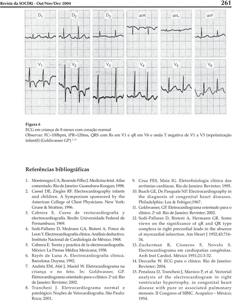 Electrocardiography infants and children. A Symposium sponsored by the American College of Chest Physicians. New York: Grune & Stratton; 1996. 3. Cabrera E.