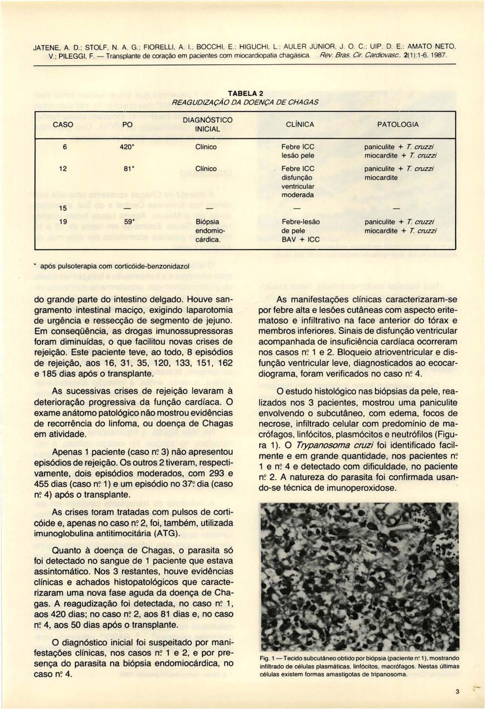 TABELA 2 REAGUD/ZAÇÃO DA DOENÇA DE CHAGAS CASO PO DIAGNÓSTICO INICIAL CLíNICA PATOLOGIA 6 420* Clínico Febre ICC lesão pele Febre ICC disfunção ventricular moderada paniculite + T cruzzí miocardite +