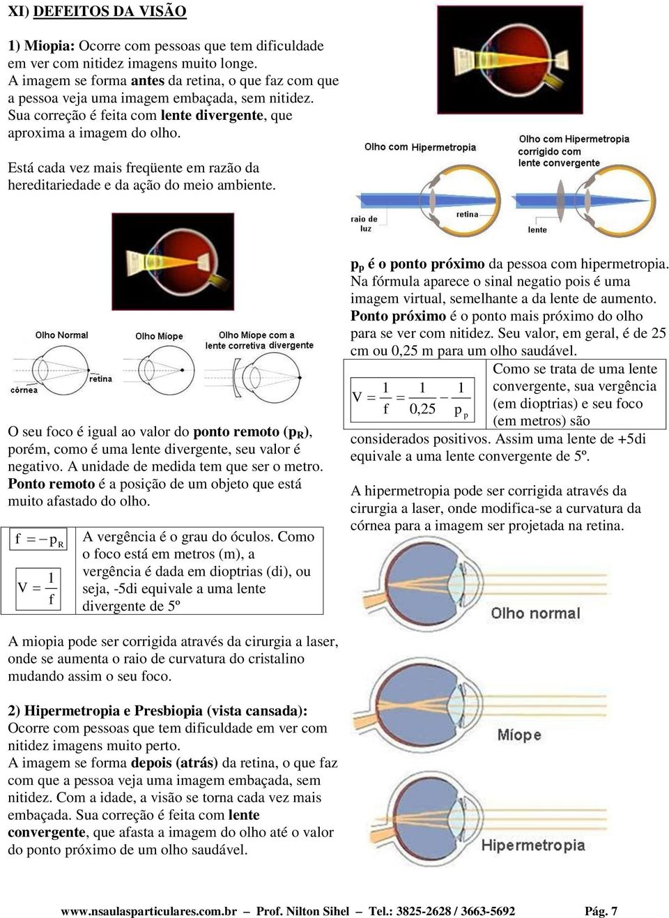 O seu oco é gual ao valor do onto remoto ( R ), orém, como é uma lente dvergente, seu valor é negatvo. A undade de medda tem que ser o metro.