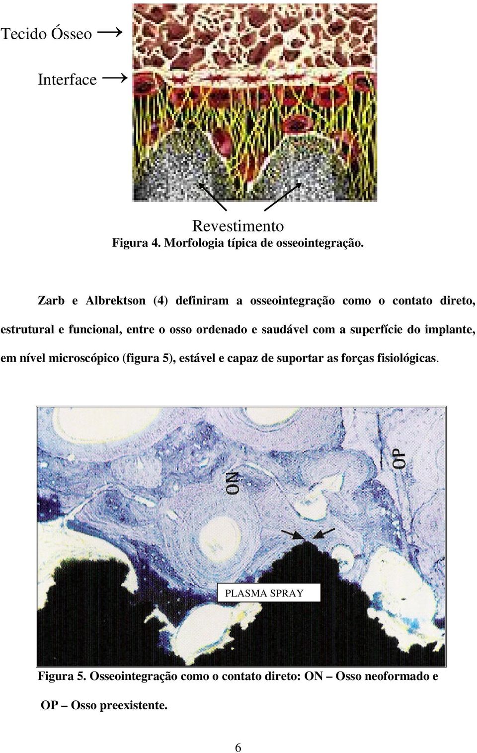 osso ordenado e saudável com a superfície do implante, em nível microscópico (figura 5), estável e capaz de