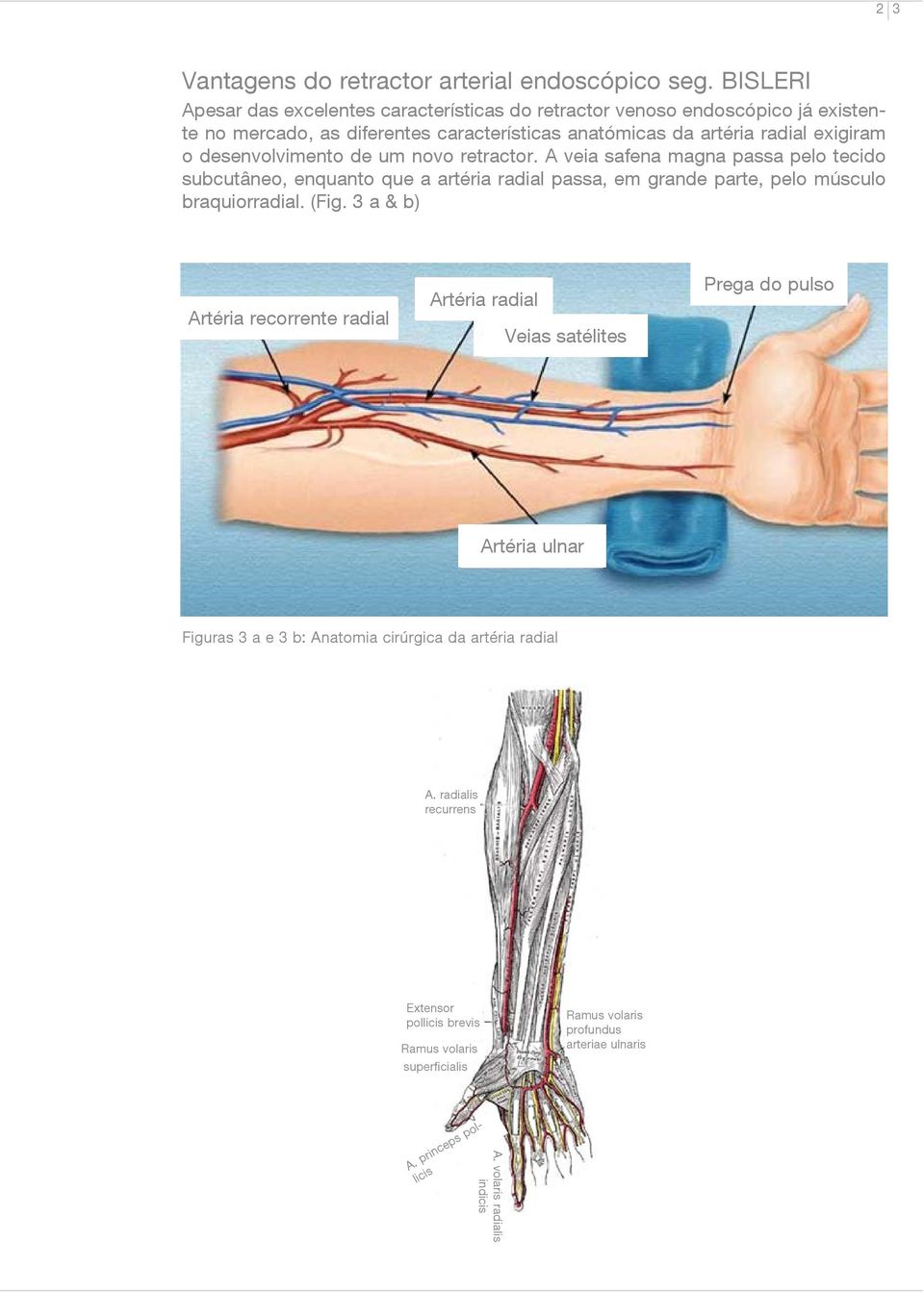 desenvolvimento de um novo retractor. A veia safena magna passa pelo tecido subcutâneo, enquanto que a artéria radial passa, em grande parte, pelo músculo braquiorradial. (Fig.