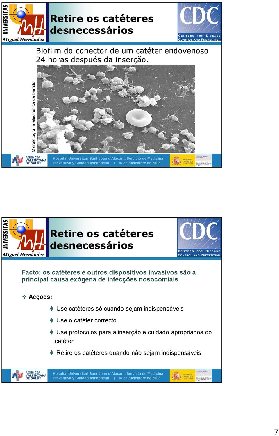 Servicio de Medicina Retire os catéteres desnecessários Facto: os catéteres e outros dispositivos invasivos são a principal causa exógena de infecções