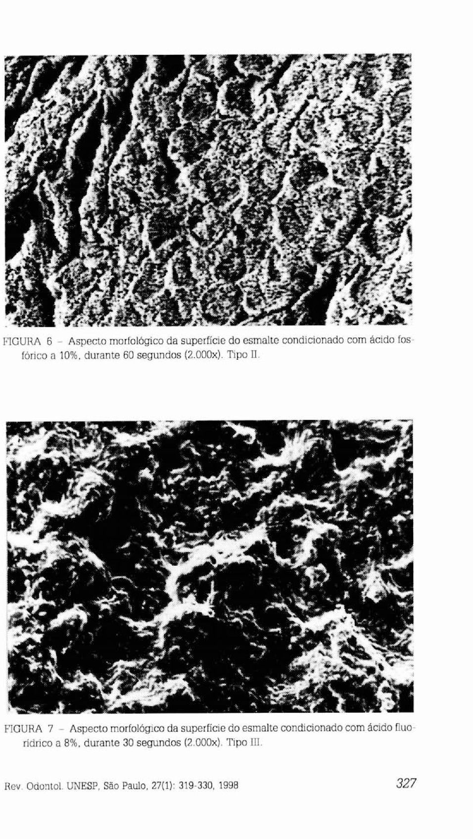 FIGURA 7 - Aspecto morfológico da superfície do esmalte condicionado com ácido